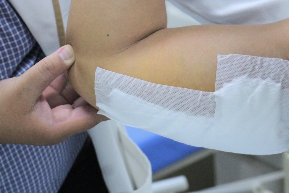 Trượt ngã, nam thanh niên bị thanh sắt 30cm đâm xuyên cánh tay Trượt ngã, nam thanh niên bị thanh sắt 30cm đâm xuyên cánh tay