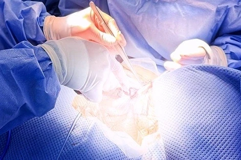 Tự ý bỏ thuốc điều trị quan trọng, người phụ nữ tắc mạch nguy kịch Tự ý bỏ thuốc điều trị quan trọng, người phụ nữ tắc mạch nguy kịch