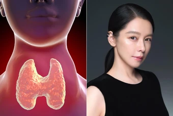 Tuyến giáp rất "ghét" bạn làm 5 việc này, bạn đang mắc bao nhiêu cái?