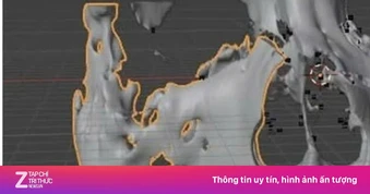 Ung thư ác tính không đau, bất ngờ 'ăn' nửa mặt bệnh nhân sau 3 tháng