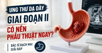 Ung thư dạ dày giai đoạn II có nên hóa trị?