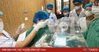 Vàng da sơ sinh có thể gây tổn thương não trẻ sơ sinh