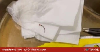 Vắt chui vào mắt sau khi rửa mặt bằng nước suối