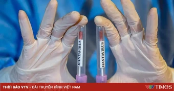 Venezuela xác nhận 3 ca tử vong do Hantavirus