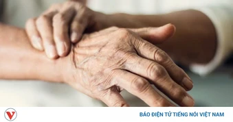 Vì sao bệnh nhân Parkinson cần phục hồi chức năng khi vẫn đi lại bình thường?