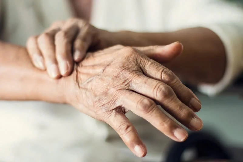 Vì sao bệnh nhân Parkinson cần phục hồi chức năng khi vẫn đi lại bình thường? Vì sao bệnh nhân Parkinson cần phục hồi chức năng khi vẫn đi lại bình thường?