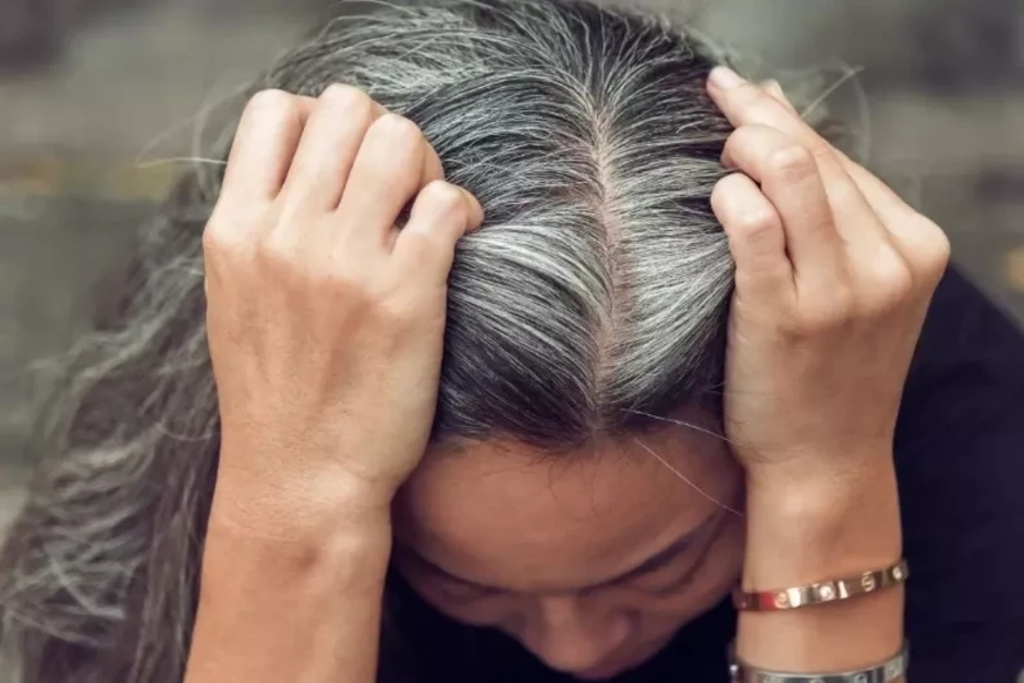 Vì sao chưa già mà tóc đã bạc?