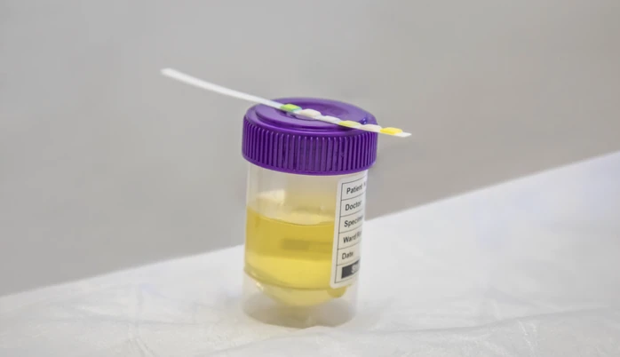 Vì sao dùng ma túy nhưng test nhanh vẫn âm tính? Vì sao dùng ma túy nhưng test nhanh vẫn âm tính?