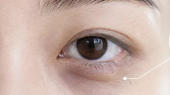 Vì sao mắt thâm quầng dù ngủ đủ? - Báo TinVina
