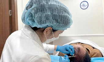 Vì sao tóc hai bên thái dương rụng nhiều? - Báo TinVina