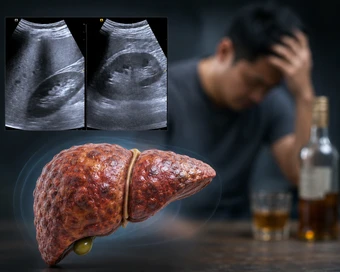 Viêm gan cấp, men gan tăng 18 lần sau 3 ngày liên tiếp dùng 1 loại đồ uống