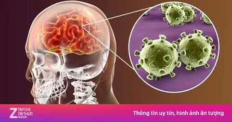 Viêm não Nhật Bản - bệnh truyền nhiễm nguy hiểm hàng đầu ở trẻ em