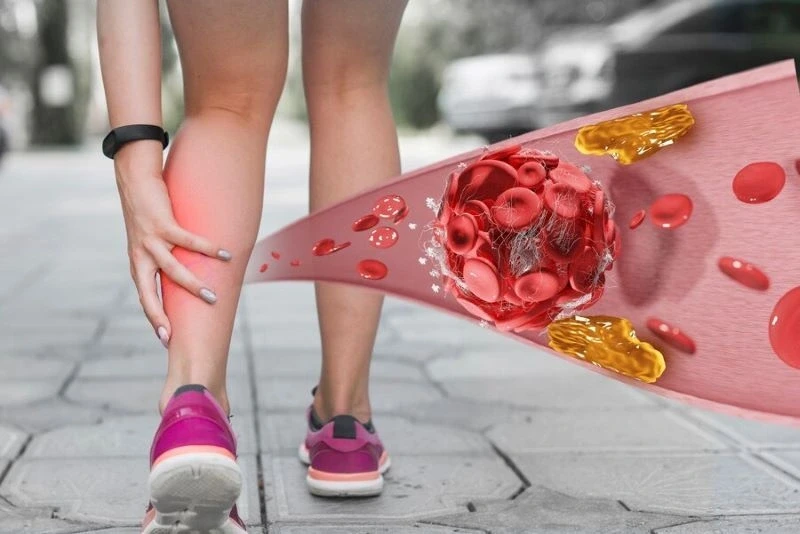 Việt Nam làm chủ nhiều kỹ thuật hiện đại điều trị bệnh mạch máu