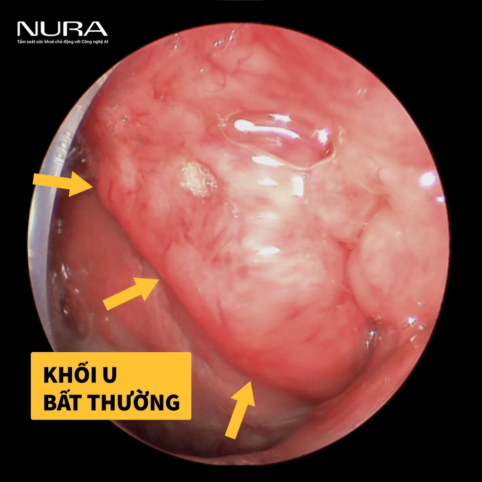 Việt Nam triển khai mô hình tầm soát tiêu chuẩn đã được ứng dụng tại nhiều quốc gia đang phát triển Việt Nam triển khai mô hình tầm soát tiêu chuẩn đã được ứng dụng tại nhiều quốc gia đang phát triển