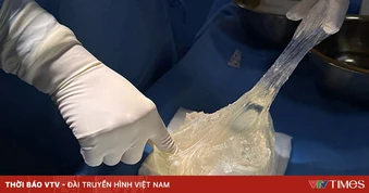 Vỡ túi ngực âm thầm chị em cần lưu ý