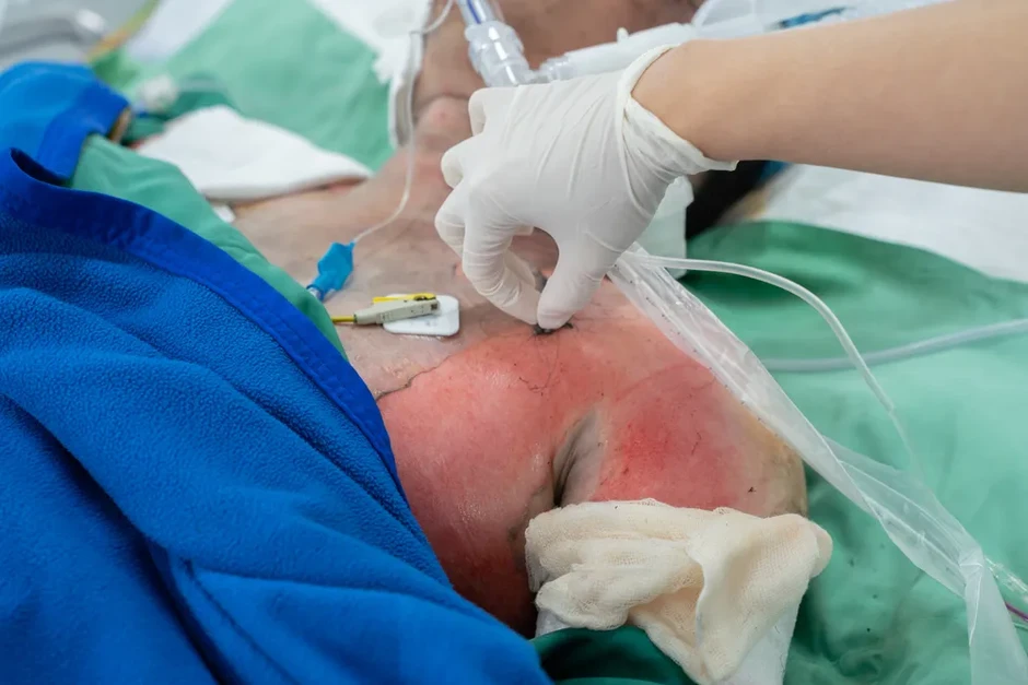 Vụ cháy nhà ở phường Chợ Lớn: Nhiều nạn nhân bị bỏng hô hấp Vụ cháy nhà ở phường Chợ Lớn: Nhiều nạn nhân bị bỏng hô hấp