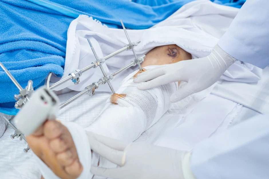 Vụ xe khách lao xuống vực, 15 người thương vong: Xuyên đêm cấp cứu nạn nhân Vụ xe khách lao xuống vực, 15 người thương vong: Xuyên đêm cấp cứu nạn nhân