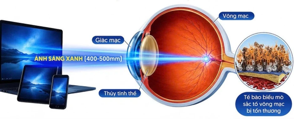 Xem tivi, điện thoại trong bóng tối gây hại mắt thế nào - Báo TinVina Xem tivi, điện thoại trong bóng tối gây hại mắt thế nào - Báo TinVina