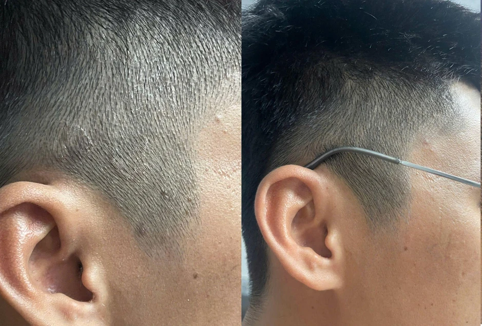 Xu hướng chăm sóc da đầu mới: Không chỉ sạch gàu mà còn phải “sạch bền vững” Xu hướng chăm sóc da đầu mới: Không chỉ sạch gàu mà còn phải “sạch bền vững”