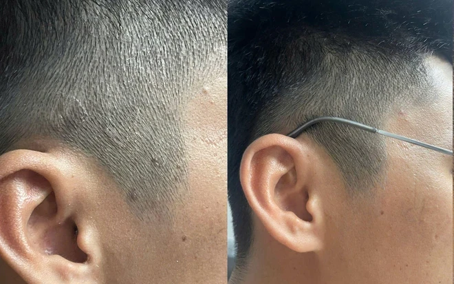 Xu hướng chăm sóc da đầu mới: Không chỉ sạch gàu mà còn phải “sạch bền vững” Xu hướng chăm sóc da đầu mới: Không chỉ sạch gàu mà còn phải “sạch bền vững”