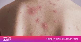 Xuất hiện ổ dịch, trường đại học Thái Lan chuyển sang học online