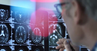 Nga thành công thử nghiệm sơ bộ chiến lược mới điều trị bệnh Alzheimer