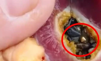 Tìm thấy vàng khi mổ vịt ở Trung Quốc