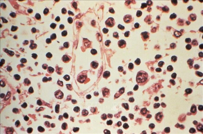 Argentina đặt những chiếc bẫy đầu tiên nhằm tóm vật chủ mang virus Hanta Argentina đặt những chiếc bẫy đầu tiên nhằm tóm vật chủ mang virus Hanta