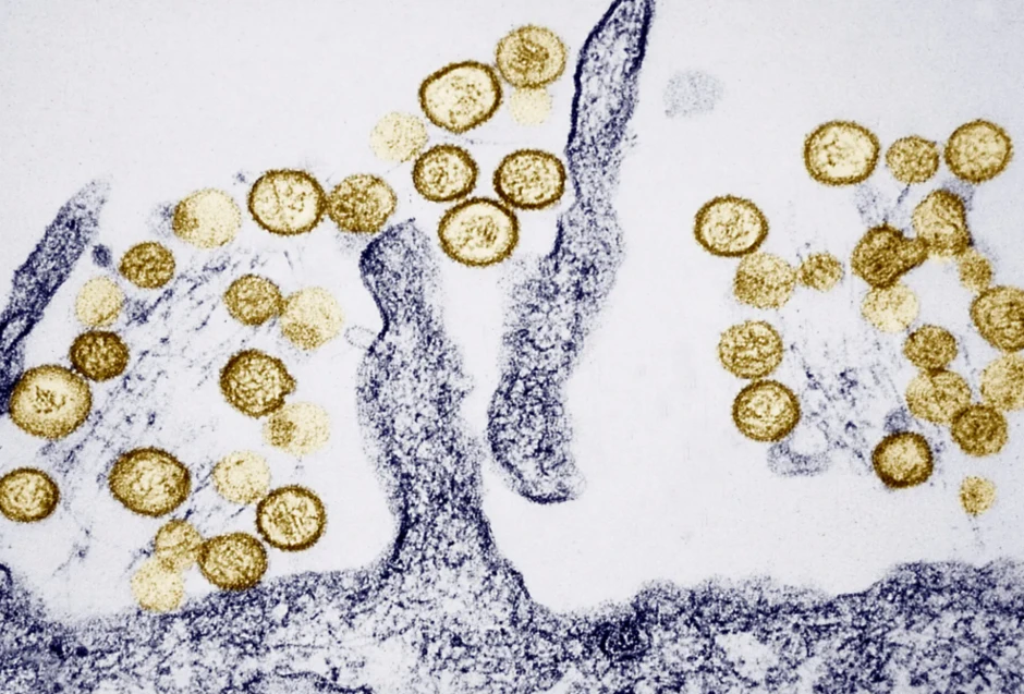 Ba người chết trên tàu biển: Virus Hanta nguy hiểm ra sao?
