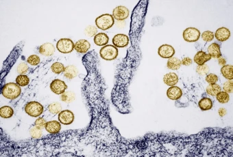 Ba người chết trên tàu biển: Virus Hanta nguy hiểm ra sao?