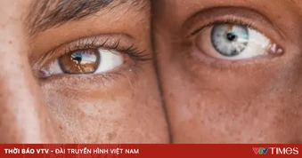 Ca phẫu thuật đổi màu mắt vĩnh viễn thành công đầu tiên trên thế giới