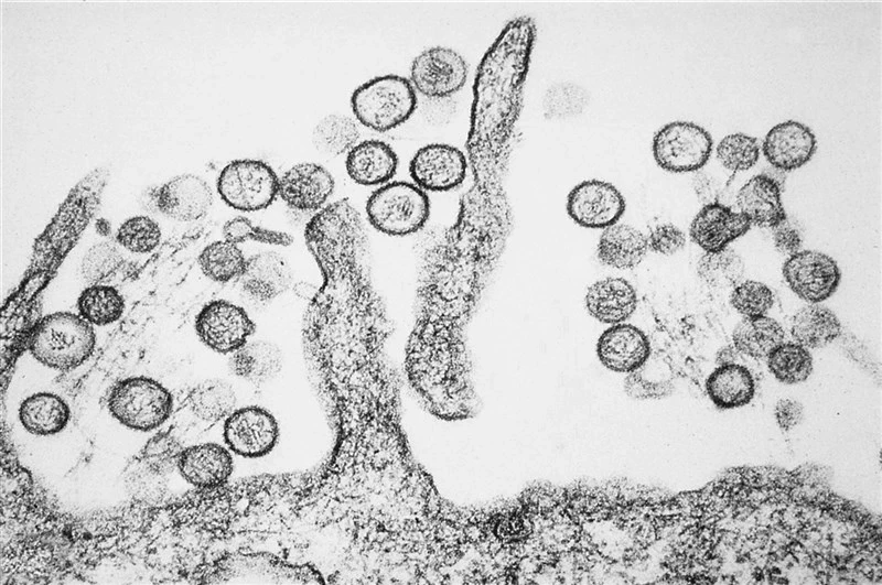 Đài Loan ghi nhận ca mắc virus Hanta thứ hai, sau ca tử vong đầu tiên Đài Loan ghi nhận ca mắc virus Hanta thứ hai, sau ca tử vong đầu tiên
