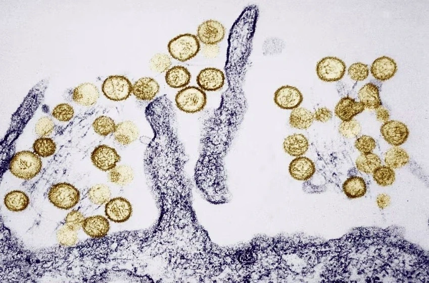 Dịch bệnh bùng phát trên tàu xuyên Đại Tây Dương: Sự nguy hiểm của virus Hanta Dịch bệnh bùng phát trên tàu xuyên Đại Tây Dương: Sự nguy hiểm của virus Hanta