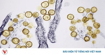 Dịch bệnh bùng phát trên tàu xuyên Đại Tây Dương: Sự nguy hiểm của virus Hanta