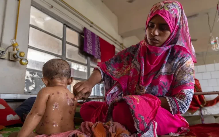 Dịch sởi bùng phát khiến ít nhất 15 người thiệt mạng ở Bangladesh Dịch sởi bùng phát khiến ít nhất 15 người thiệt mạng ở Bangladesh