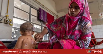 Dịch sởi bùng phát khiến ít nhất 15 người thiệt mạng ở Bangladesh