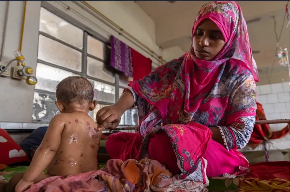 Dịch sởi cướp đi sinh mạng của hơn 500 trẻ em ở Bangladesh Dịch sởi cướp đi sinh mạng của hơn 500 trẻ em ở Bangladesh