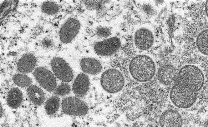 Hai nhà nghiên cứu bị truy tố vì đưa trái phép virus đậu mùa khỉ vào Mỹ Hai nhà nghiên cứu bị truy tố vì đưa trái phép virus đậu mùa khỉ vào Mỹ