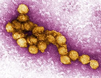 Hy Lạp tăng cường ứng phó khi số ca nhiễm virus Tây sông Nile tăng cao