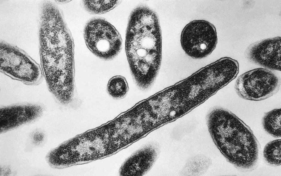 Mỹ: Dịch Legionnaires tại New York khiến 3 người tử vong Mỹ: Dịch Legionnaires tại New York khiến 3 người tử vong