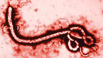 Mỹ siết kiểm soát y tế và hạn chế nhập cảnh trước nguy cơ virus Ebola