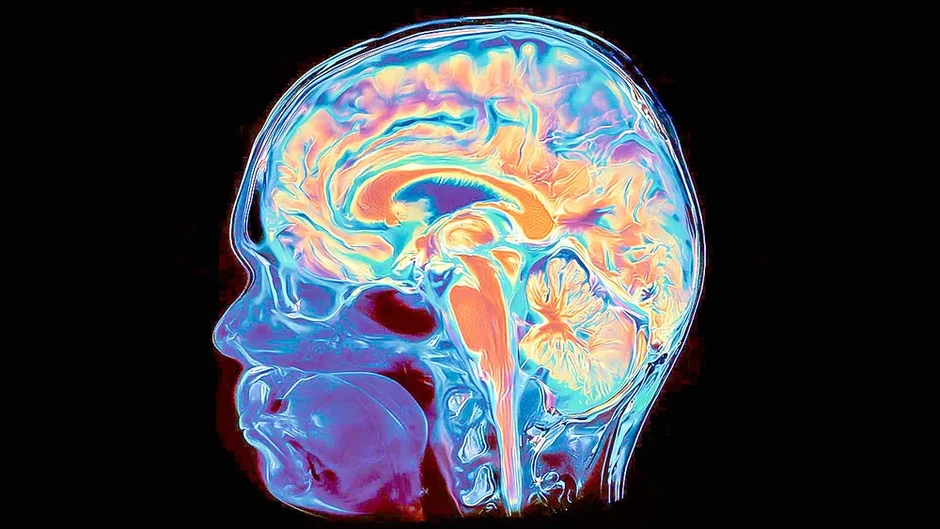 Phát hiện não người phát triển từ hai hệ tế bào riêng biệt Phát hiện não người phát triển từ hai hệ tế bào riêng biệt