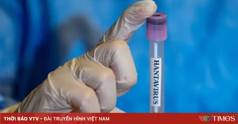 Quốc gia trải qua đợt bùng phát hantavirus kỷ lục
