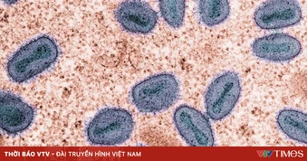 Singapore xác nhận 2 ca mắc đậu mùa khỉ lây nhiễm trong cộng đồng đầu tiên