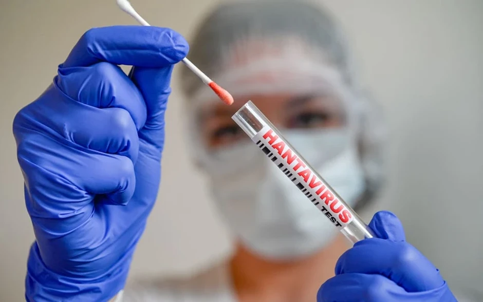 Tại sao dịch virus Hanta khác COVID-19? Tại sao dịch virus Hanta khác COVID-19?