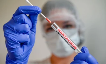 Tại sao dịch virus Hanta khác COVID-19?