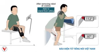 Trung Quốc phát triển robot đeo hỗ trợ trẻ mắc teo cơ tủy sống phục hồi vận động