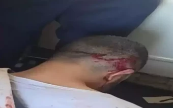 Video cận cảnh cơ phó bị khống chế sau âm mưu cướp máy bay Flydubai