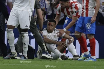 Mbappe đổ máu, VAR mất tích, Real nổi giận