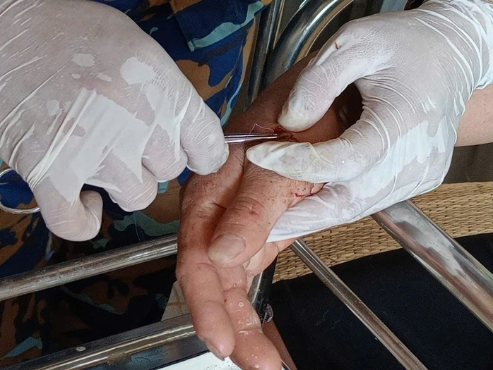 Chiến sĩ Nhà giàn DK1 kịp thời cứu ngư dân bị cá chình cắn Chiến sĩ Nhà giàn DK1 kịp thời cứu ngư dân bị cá chình cắn